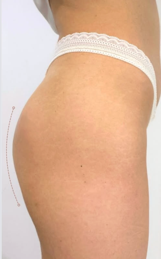 Right Image